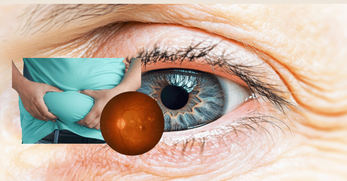 Bauchfett als Risiko bei AMD