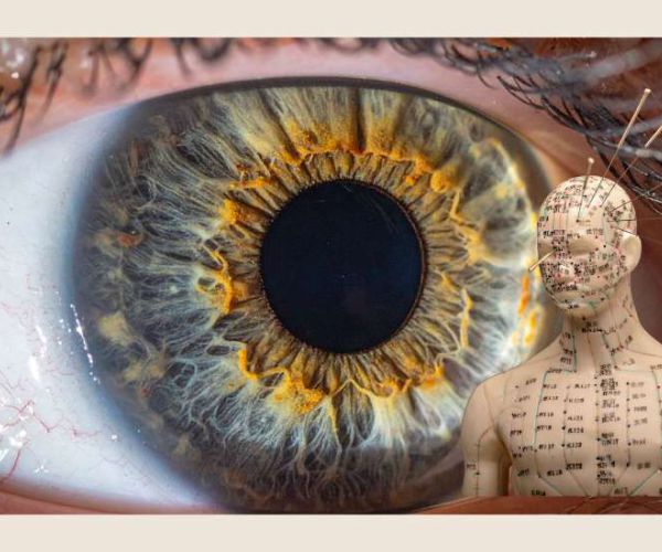 Augenakupunktur bei AMD 